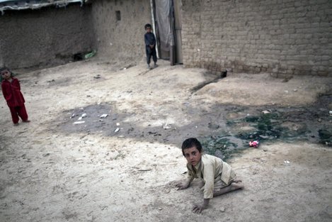 A boy with Polio in Islamabad, 2011 Credit: Behrouz Mehri/AFP/Getty Images