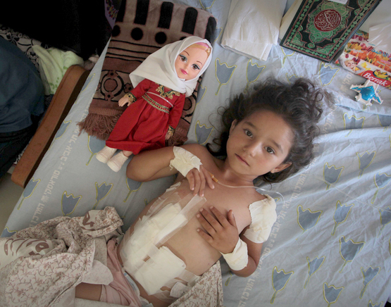 The child shown above was injured in Gaza, 2014. Serves her right for choosing to live among terrorists, amiright?